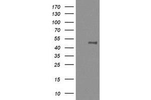 Image no. 6 for anti-Mitogen-Activated Protein Kinase Kinase 1 (MAP2K1) antibody (ABIN1499393) (MEK1 Antikörper)