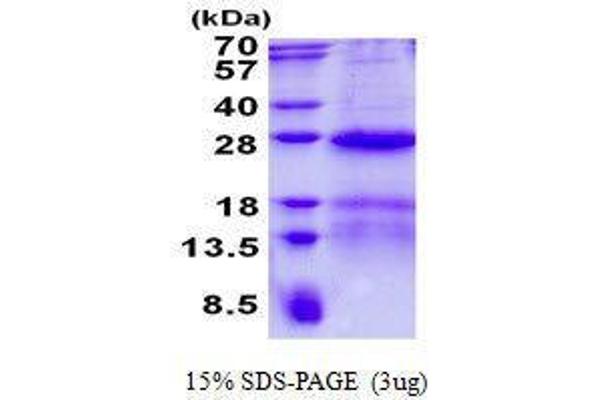 NOP16 Protein