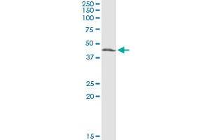 Western Blotting (WB) image for anti-Cystathionase (Cystathionine gamma-Lyase) (CTH) (AA 1-405) antibody (ABIN560521)