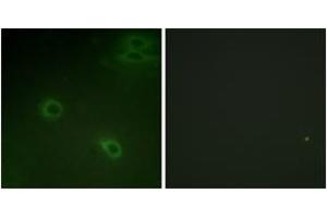 Immunofluorescence analysis of HeLa cells, using CXCR4 (Phospho-Ser339) Antibody. (CXCR4 Antikörper  (pSer339))