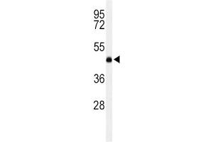 Western Blotting (WB) image for anti-Lecithin-Cholesterol Acyltransferase (LCAT) antibody (ABIN3004355) (LCAT Antikörper)