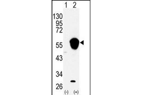 ALDH3A1 Antikörper  (N-Term)