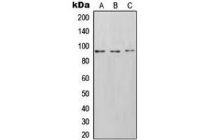Western blot analysis of CD54 expression in Saos2 (A), HT1080 (B), Raji (C) whole cell lysates. (ICAM1 Antikörper  (C-Term))