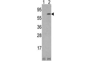 Western blot analysis of M-CSF (arrow) using rabbit polyclonal M-CSF Antibody (Center) . (M-CSF/CSF1 Antikörper  (Middle Region))
