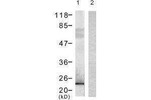 Western blot analysis of extract from 293 cells transfected with (lane 1) or without (lane 2) DYKDDDDK-tagged Bad using DYKDDDDK-Tag monoclonal Antibody (E1T508). (DYKDDDDK Tag Antikörper)