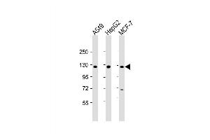 Western Blot at 1:2000 dilution Lane 1: A549 whole cell lysate Lane 2: HepG2 whole cell lysate Lane 3: MCF-7 whole cell lysate Lysates/proteins at 20 ug per lane. (Klotho beta Antikörper  (AA 1-29))