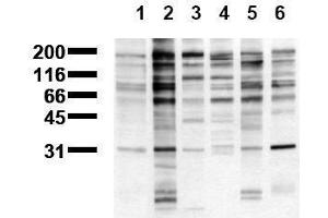 Western Blotting (WB) image for anti-Phosphotyrosine (phosphorylated) antibody (ABIN126874) (Phosphotyrosine Antikörper  (phosphorylated))