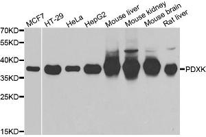 Western blot analysis of extracts of various cell lines, using PDXK antibody (ABIN5974032) at 1/1000 dilution. (PDXK Antikörper)