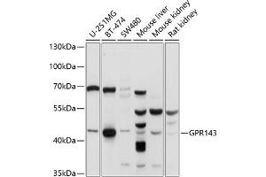 Western blot analysis of extracts of various cell lines, using GPR143 antibody (ABIN6131675, ABIN6141346, ABIN6141347 and ABIN6214863) at 1:1000 dilution. (GPR143 Antikörper  (AA 314-404))