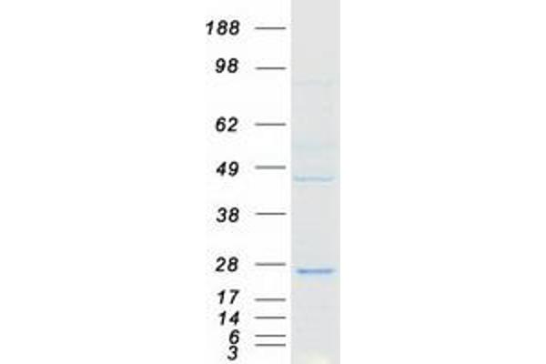 FAM96A Protein (Transcript Variant 1) (Myc-DYKDDDDK Tag)