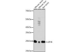 Western blot analysis of extracts of various cell lines, using eIF4E antibody (ABIN7267048) at 1:1000 dilution. (EIF4E Antikörper)