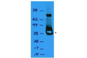 Western blot using  affinity purified anti-Lac I antibody shows detection of a 38 kDa band corresponding to recombinant Lac I (arrowhead). (LacI Antikörper)