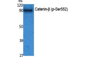 Western Blotting (WB) image for anti-Catenin, beta (CATNB) (pSer552) antibody (ABIN3173575) (beta Catenin Antikörper  (pSer552))