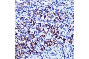 Immunohistochemistry of paraffin-embedded rat ovary using PALLD Rabbit pAb  at dilution of 1:100 (40x lens). (PALLD Antikörper  (AA 383-672))