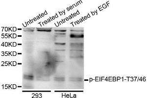 Western blot analysis of extracts of various cells, using Phospho-EIF4EBP1-T37/46 antibody. (eIF4EBP1 Antikörper  (pThr36))