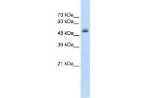 Western Blotting (WB) image for anti-Pre-mRNA Processing Factor 19 (PRPF19) antibody (ABIN2462670) (PRP19 Antikörper)