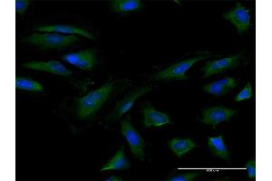 Immunofluorescence of purified MaxPab antibody to EIF4B on HeLa cell. (EIF4B Antikörper  (AA 1-611))