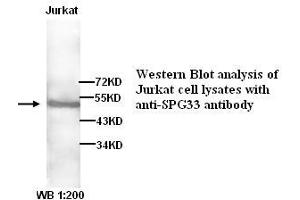 Image no. 1 for anti-Zinc Finger, FYVE Domain Containing 27 (ZFYVE27) antibody (ABIN790894) (ZFYVE27 Antikörper)