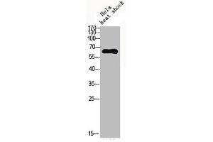 Western Blot analysis of HELA cells using Phospho-AMPKα1 (S496) Polyclonal Antibody (PRKAA1 Antikörper  (pSer469))