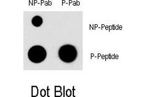 Image no. 1 for anti-Myocyte Enhancer Factor 2C (MEF2C) (pSer396) antibody (ABIN5552137) (MEF2C Antikörper  (pSer396))