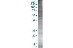 GPRC5C transfected lysate. (GPRC5C 293T Cell Transient Overexpression Lysate(Denatured))