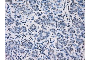 Immunohistochemistry (IHC) image for anti-Fc Fragment of IgG, Low Affinity IIa, Receptor (CD32) (FCGR2A) antibody (ABIN1497262) (FCGR2A Antikörper)