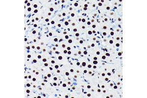 Immunohistochemistry of paraffin-embedded rat ovary using TDP-43/TARDB Rabbit mAb (ABIN7270730) at dilution of 1:100 (40x lens). (TARDBP Antikörper)
