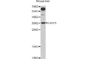 Western blot analysis of extracts of mouse liver, using CASP6 Antibody (ABIN5970901) at 1/1000 dilution. (Caspase 6 Antikörper)