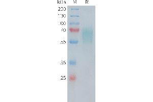 Human CD30 Protein, His Tag on SDS-PAGE under reducing condition. (TNFRSF8 Protein (AA 19-379) (His tag))
