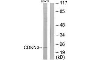 Western blot analysis of extracts from LOVO cells, using CDKN3 Antibody. (CDKN3 Antikörper  (AA 31-80))