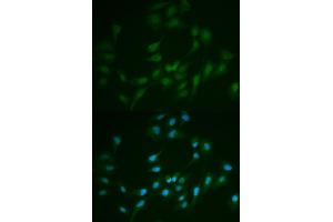 Immunofluorescence analysis of MCF-7 cells using LIG1 antibody. (LIG1 Antikörper)