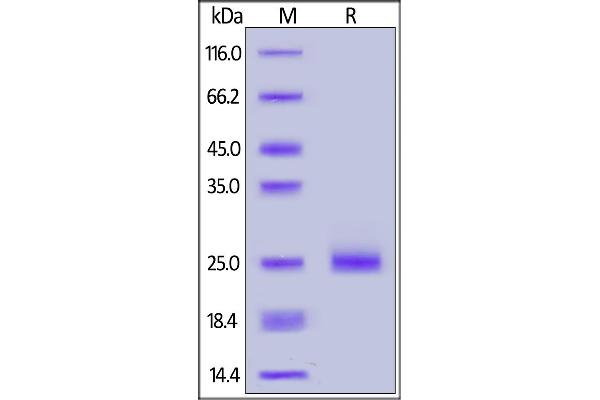 IL17C Protein (AA 19-197) (His tag)