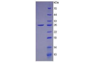 SDS-PAGE analysis of Human Connexin 43 Protein. (Connexin 43/GJA1 Protein)