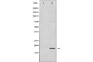 Western blot analysis of Cofilin expression in COLO205 whole cell lysates,The lane on the left is treated with the antigen-specific peptide. (Cofilin Antikörper  (N-Term))