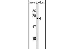 Mouse BAD Antibody (Center //) (ABIN6243058 and ABIN6577363) western blot analysis in mouse cerebellum tissue lysates (35 μg/lane). (BAD Antikörper  (AA 90-118))