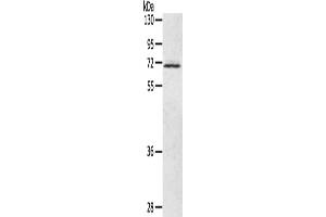 Western Blotting (WB) image for anti-Leukotriene A4 Hydrolase (LTA4H) antibody (ABIN2430401) (LTA4H Antikörper)