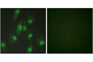 Immunofluorescence analysis of HeLa cells, using Chk1 (Ab-286) Antibody. (CHEK1 Antikörper  (AA 256-305))