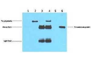 Immunoprecipitation (IP) image for anti-DYKDDDDK Tag antibody (ABIN3181074)