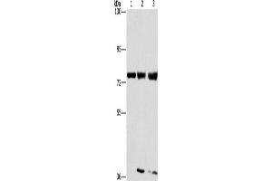 Western Blotting (WB) image for anti-gamma-Glutamyl Carboxylase (GGCX) antibody (ABIN2423527) (GGCX Antikörper)