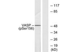 Western Blotting (WB) image for anti-Vasodilator-Stimulated phosphoprotein (VASP) (pSer157) antibody (ABIN2888553) (VASP Antikörper  (pSer157))