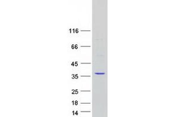 CAPZB Protein (Myc-DYKDDDDK Tag)