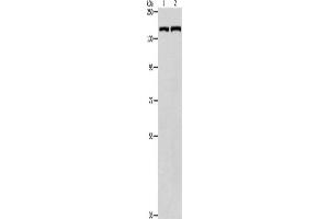 Western Blotting (WB) image for anti-Patched 1 (PTCH1) antibody (ABIN2422095) (Patched 1 Antikörper)