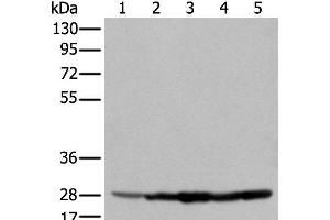 Western blot analysis of 293T cell Hela cell A549 cell using ECI1 Polyclonal Antibody at dilution of 1:350 (DCI Antikörper)