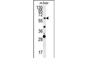 ZCCHC5 Antibody (N-term) (ABIN654002 and ABIN2843937) western blot analysis in mouse liver tissue lysates (15 μg/lane). (ZCCHC5 Antikörper  (N-Term))