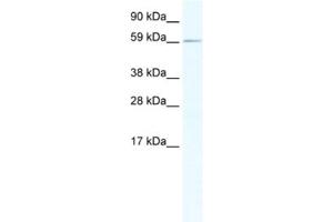 Western Blotting (WB) image for anti-RNA Binding Motif Protein 14 (RBM14) antibody (ABIN2461498) (RBM14 Antikörper)