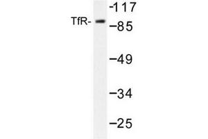 Image no. 2 for anti-Transferrin Receptor (p90, CD71) (TFRC) antibody (ABIN272097) (Transferrin Receptor Antikörper)