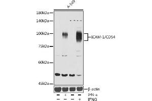Western blot analysis of extracts of A-549 cells, using ICAM-1/CD54 antibody (ABIN6129231, ABIN6142118, ABIN6142120 and ABIN6221235) at 1:1000 dilution. (ICAM1 Antikörper  (AA 250-480))