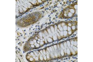 Immunohistochemistry of paraffin-embedded human colon using AK1 Antibody. (Adenylate Kinase 1 Antikörper)