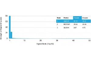 Analysis of Protein Array containing more than 19,000 full-length human proteins using AMACR / p504S Mouse Monoclonal Antibody (AMACR/1864). (AMACR Antikörper  (AA 297-394))