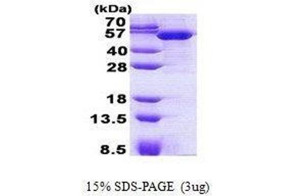 TBCEL Protein